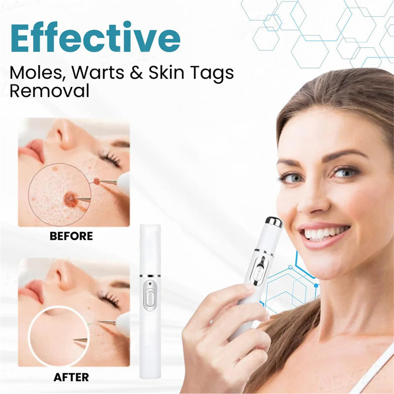 Mole & Wart Removal Pen